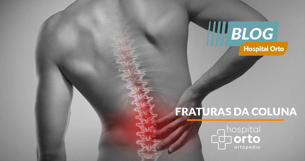 Fraturas Da Coluna Hospital Orto Hospital Especializado Em Ortopedia S O Jos Dos Campos